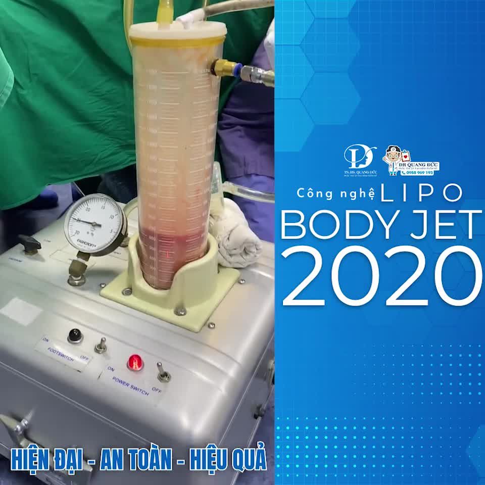 Lấy lại thân hình nóng bỏng nhờ công nghệ LIPO BODYJET 2020