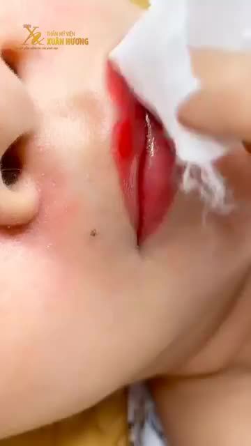 MÔI THÂM VIỀN, XỈN MÀU "BIẾN HÌNH" HỒNG HÀO CĂNG MƯỚT SAU 5 NGÀY PHUN MÔI TẠI TMV XUÂN HƯƠNG