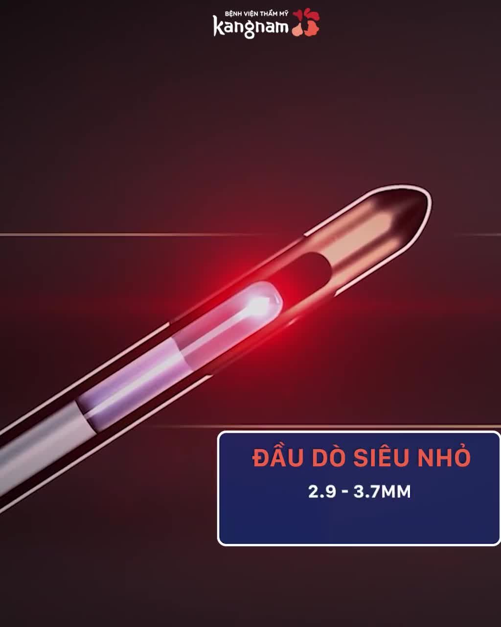 SIÊU HỦY MỠ với công nghệ Vaser Lipo 4D