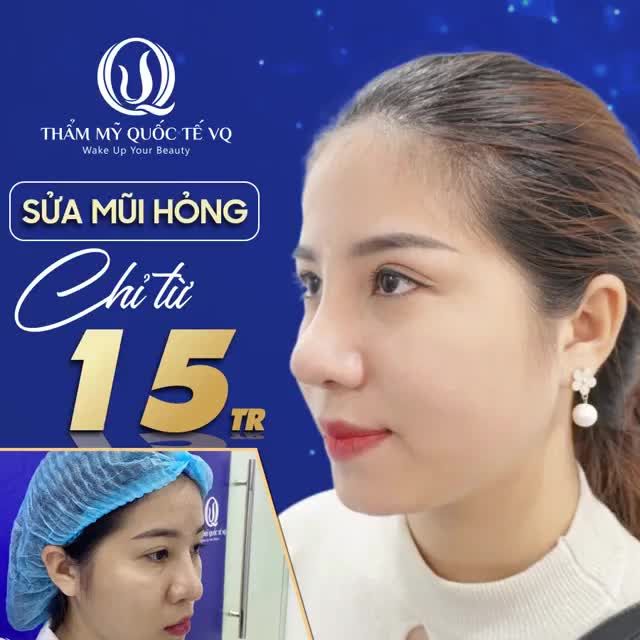 THẢM HỌA NÂNG MŨI HỎNG