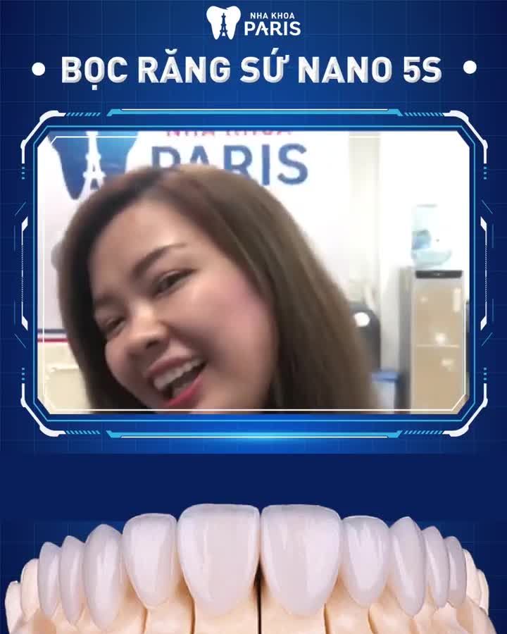 2 NGÀY BỌC SỨ -  Răng hết XẤU XÍ