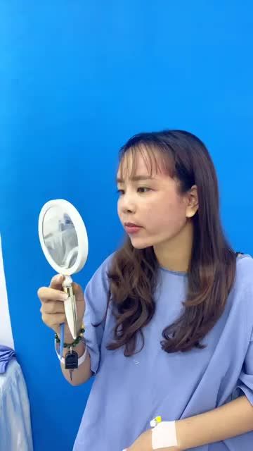 Cùng chiêm ngưỡng kết quả của khách hàng cấy mỡ toàn mặt chỉ sau 60 phút thực hiện nhé!