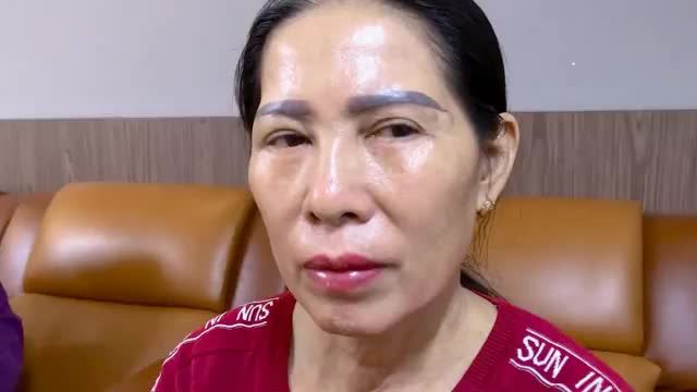CẢI THIỆN TÌNH TRẠNG DA DƯ CHÙNG SỤP MÍ CHE KHUẤT TÂM NHÌN + MÍ DƯỚI NHIỀU BỌNG MỠ GÂY NẶNG MẮT -GIÚP VỊ KHÁCH HÀNG TRỞ NÊN RẠNG RỠ TRẺ TRUNG HƠN