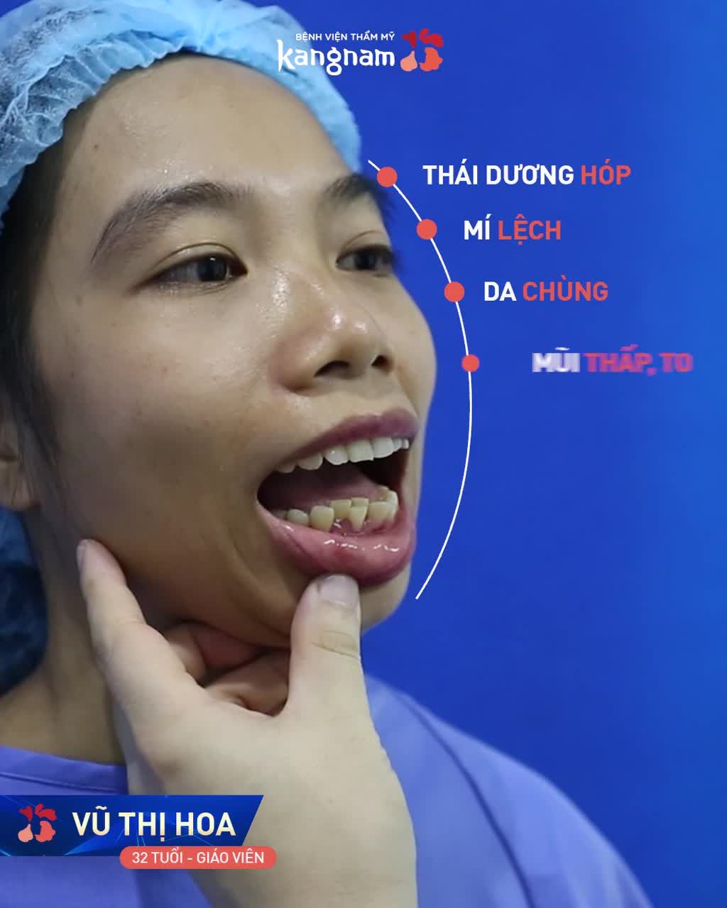 Hàm hô - Cằm lẹm - Mũi thấp và khát khao tự tin trên bục giảng...