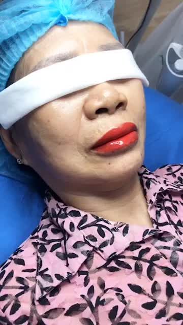 Khi đôi môi em đỏ mọng, ai cũng muốn nói "Anh yêu em" Môi Khách Hàng Phun và xử lý thâm