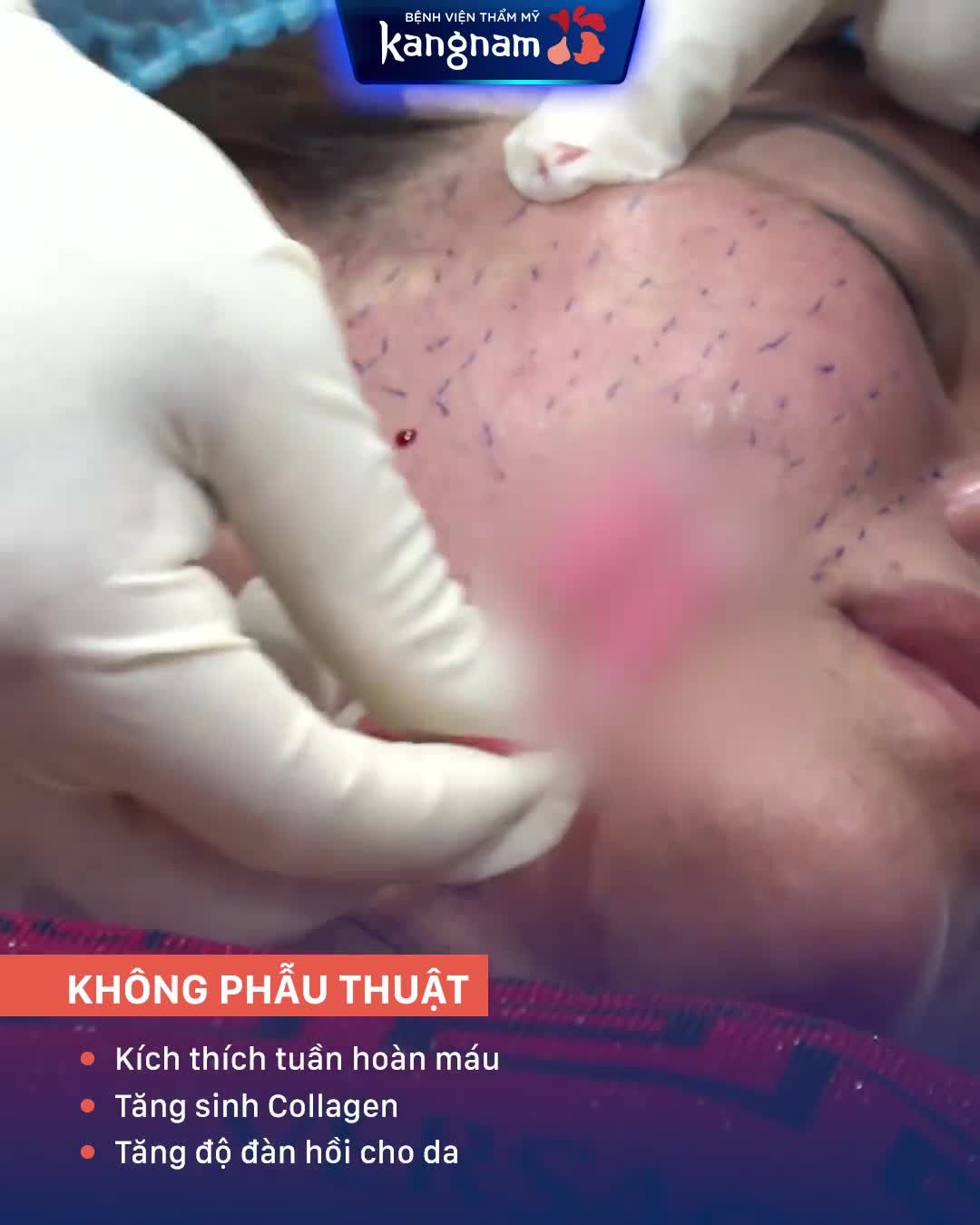 GIẢI PHÁP CỨU CHỮA làn da NHĂN NHEO, CHẢY XỆ cho các chị U40!