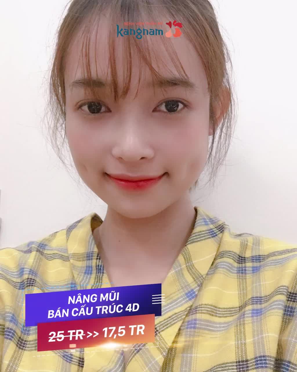 Đây rồi, Bảng giá Thẩm mỹ mũi Tháng 9