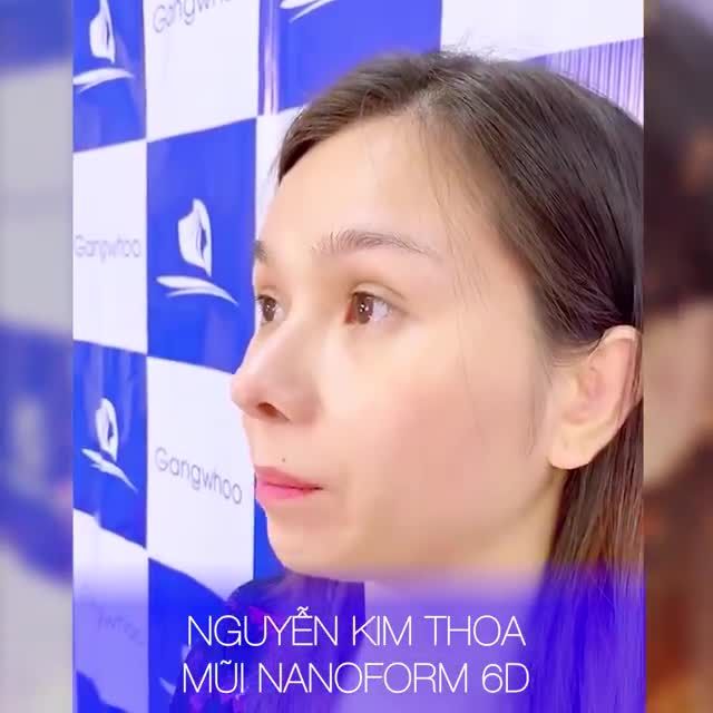 NÂNG MŨI TẠI GANGWHOO CÓ ĐAU KHÔNG, XEM NGAY ĐỂ BIẾT