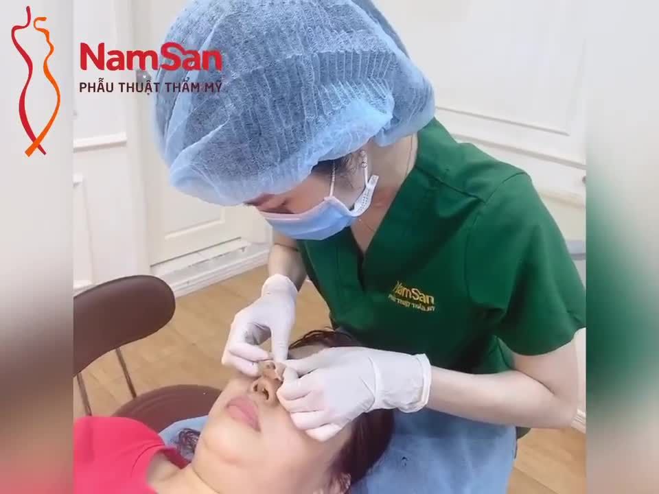 Sau khi nâng mũi, khách hàng nên thực hiện đúng theo hướng dẫn của bác sĩ để có kết quả tốt nhất.