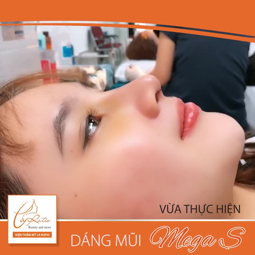 “THẬT BẤT NGỜ VỚI DÁNG MŨI MÌNH SAU KHI PHẪU THUẬT”