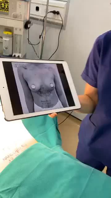 HOT HOT HOT VÒNG 1 SEXY NÓNG BỎNG VỚI DÒNG TÚI NANOCHIP EG