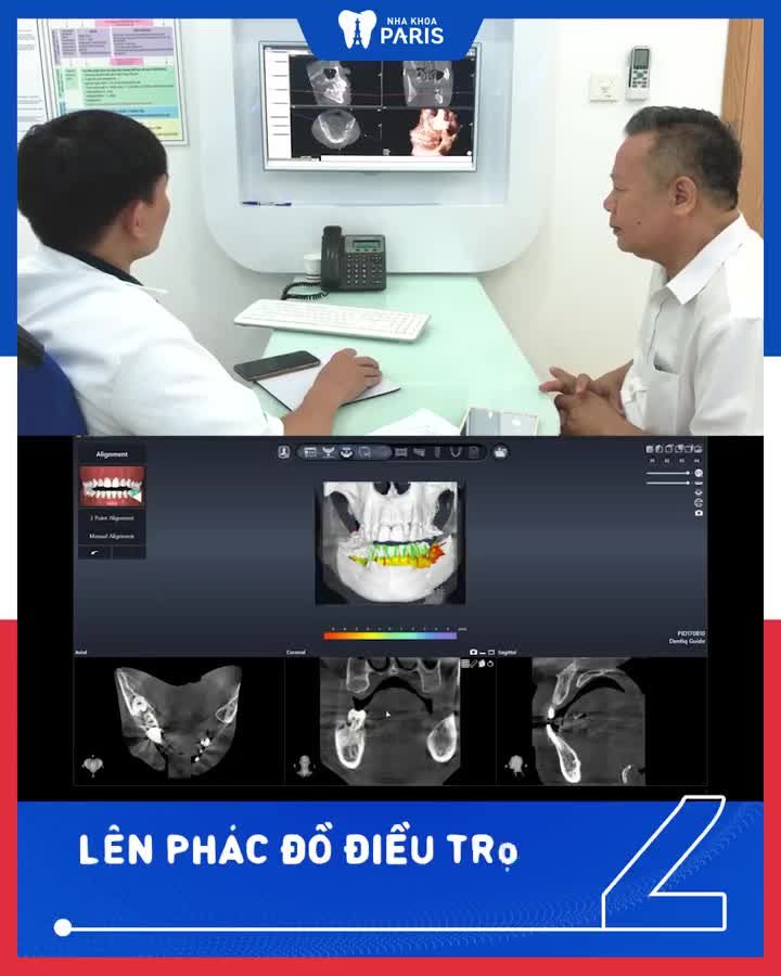 Khôi phục răng mất, ăn nhai tốt sau 5 ngày