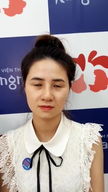 Khách hàng thay đổi "ngoạn mục" chỉ sau 10 ngày cắt chỉ nâng mũi cấu trúc 4D