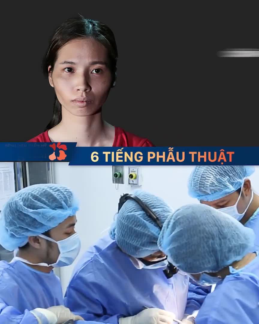 6 tiếng phẫu thuật - 6 dịch vụ, cô gái Nam Định đã có màn lột xác đỉnh cao!