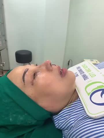 COMBO CHO CÔ KHÁCH TỪ ĐÀ LẠT VÀO