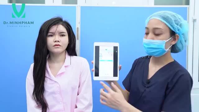 KẾT QUẢ CA CẤY MỠ BIO NANO