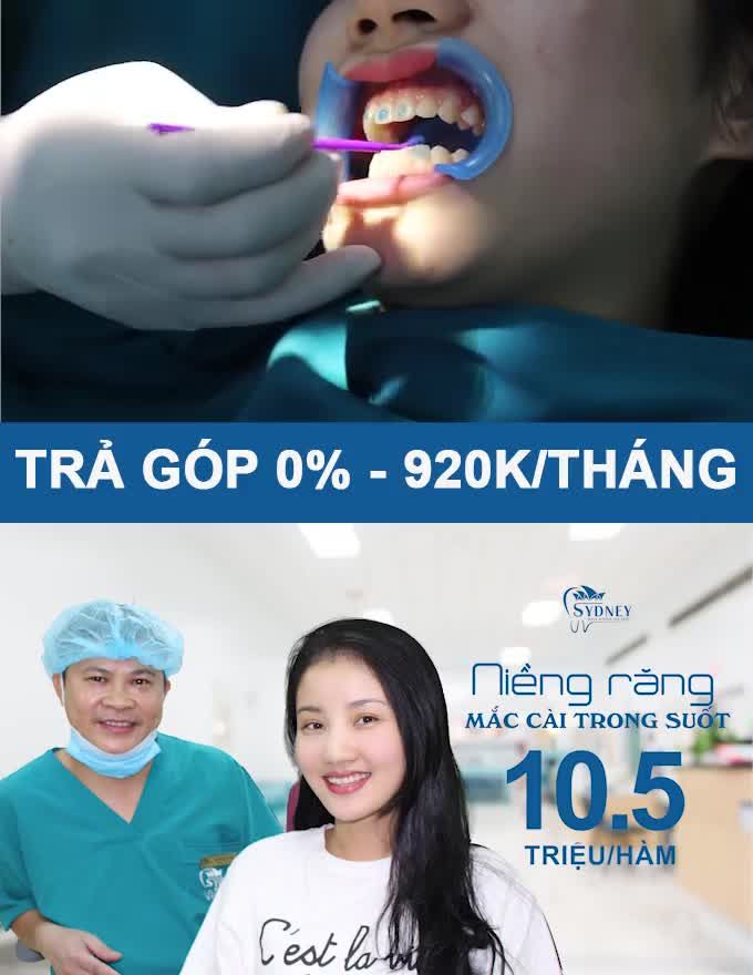 Niềng răng là vấn đề bạn đang băn khoăn
