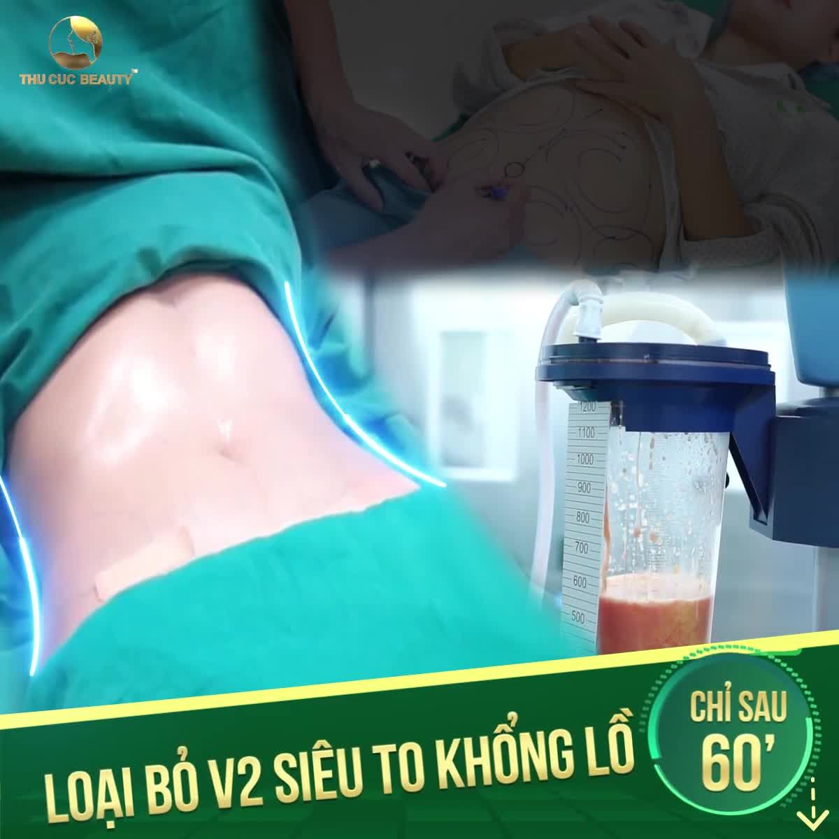 "HÔ BIẾN" V2 SIÊU TO KHỔNG LỒ TRONG NHÁY MẮT