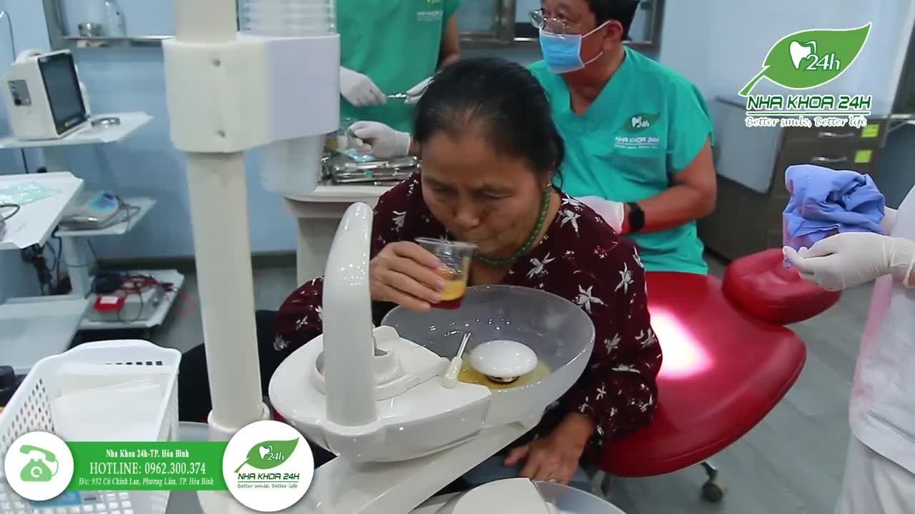 Case nhổ răng khôn do bác sĩ Nguyễn Mạnh Hà thực hiện