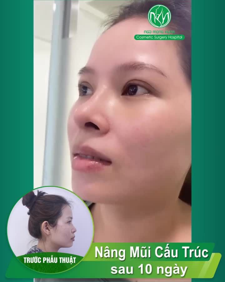 DÁNG MŨI THỜI THƯỢNG DÀNH CHO CÁC QUÝ CÔ