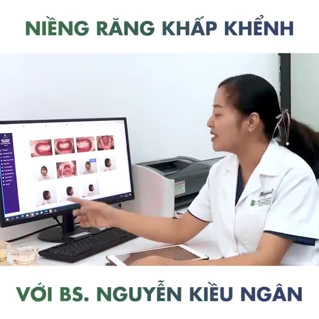 NHỮNG ĐIỀU CẦN BIẾT VỀ NIỀNG RĂNG KHẤP KHỂNH