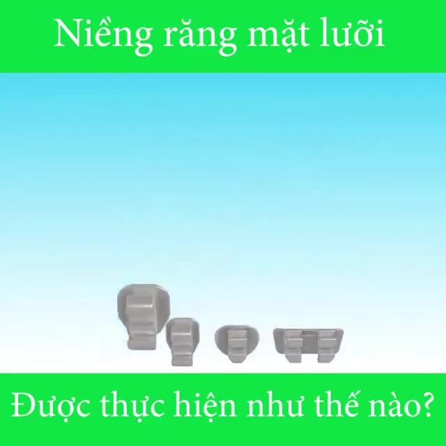 NIỀNG RĂNG MẶT LƯỠI ĐƯỢC THỰC HIỆN NHƯ THẾ NÀO