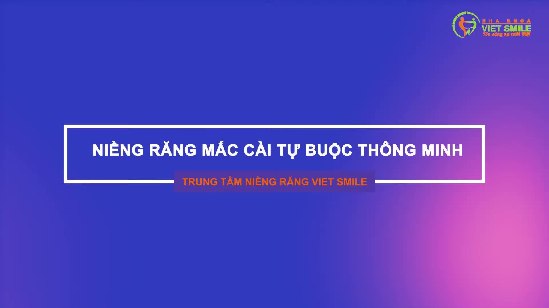 Tại sao niềng răng mắc cài tự buộc thông minh đang được đa số khách hàng lựa chọn?
