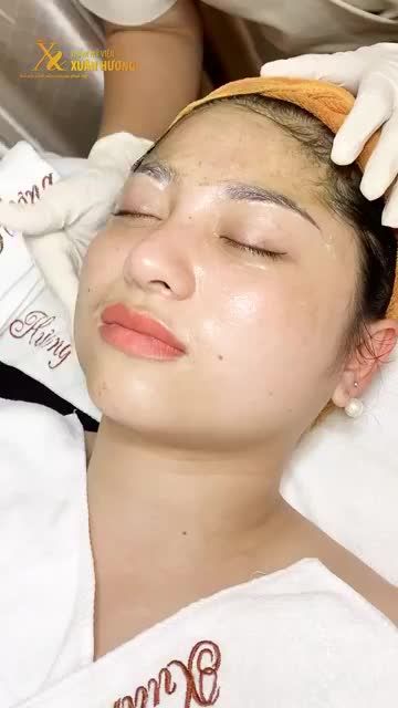 TÁI TẠO DA HIỆU QUẢ MÙA HANH KHÔ VỚI CẤY KHOÁNG SINH HỌC THẢO DƯỢC
