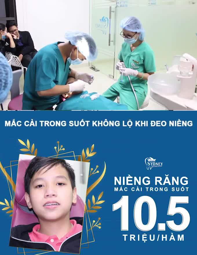 TIẾN ĐỘ NIỀNG RĂNG NHƯ THẾ NÀO? RĂNG CHẠY NHƯ THẾ NÀO ?