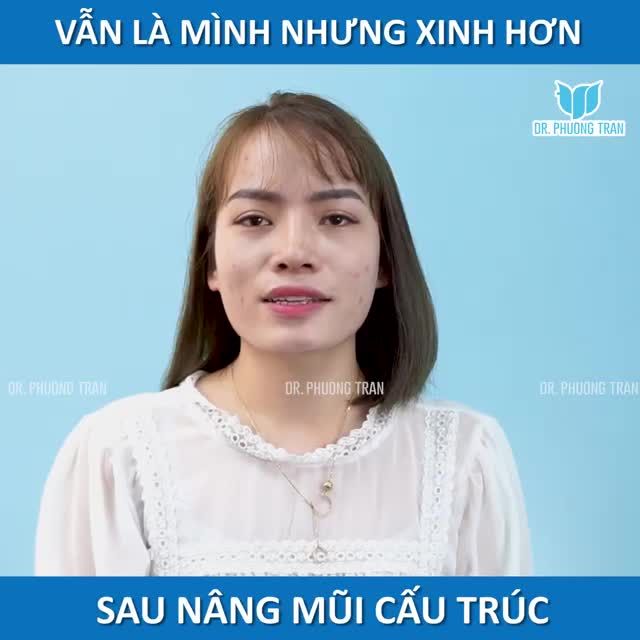 TRƯỚC KIA KHÔNG TIN NÂNG MŨI KHÔNG ĐAU - NHƯNG LÀM RỒI MỚI THẤY NÂNG MŨI KHÔNG ĐAU THẬT