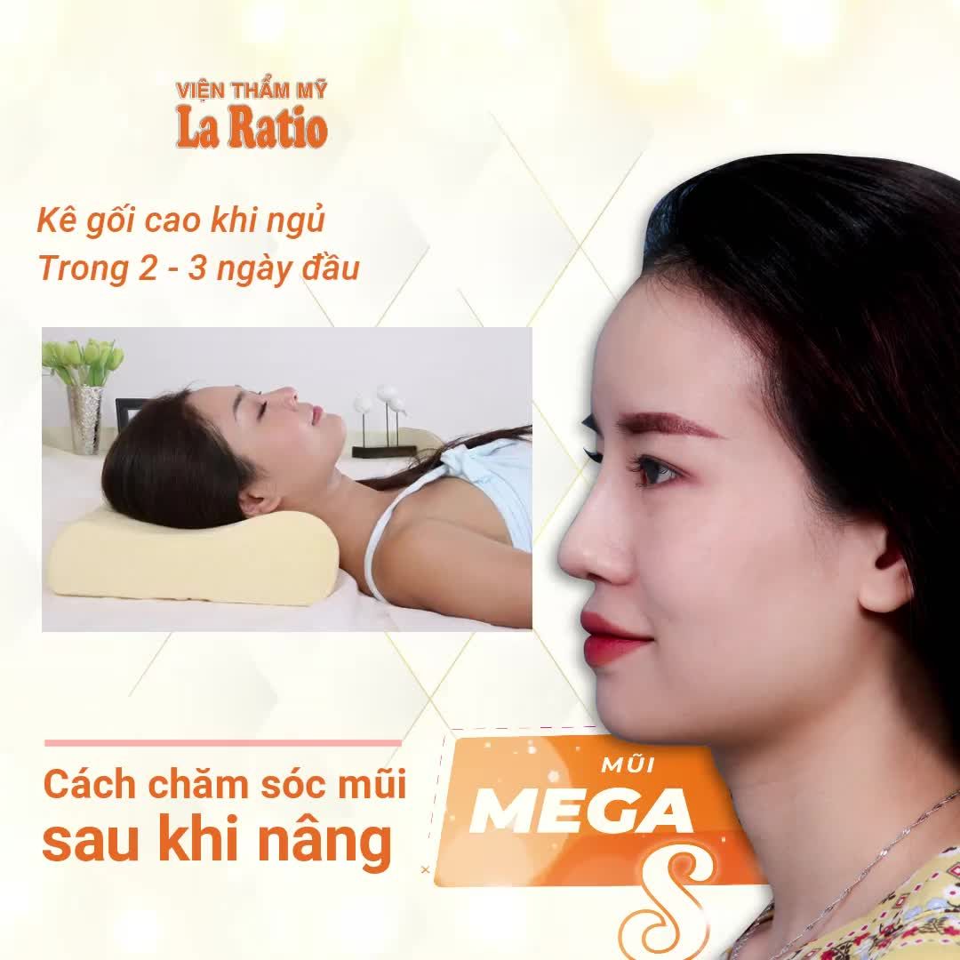 BÍ QUYẾT ĐẠT HIỆU QUẢ CAO SAU KHI NÂNG MŨI CẤU TRÚC MEGA S ️
