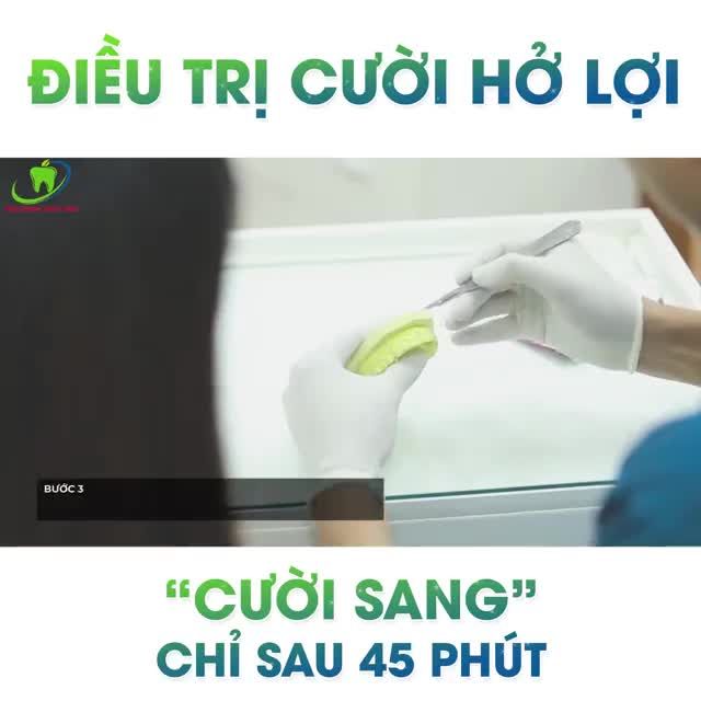 DÀNH CẢ THANH XUÂN CHỈ ĐỂ CÂN NHẮC CÓ NÊN KHẮC PHỤC NỤ CƯỜI HỞ LỢI HAY KHÔNG