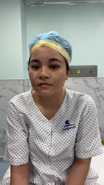 Kết quả sau phẫu thuật chỉnh sụp cơ nâng mi của khách hàng