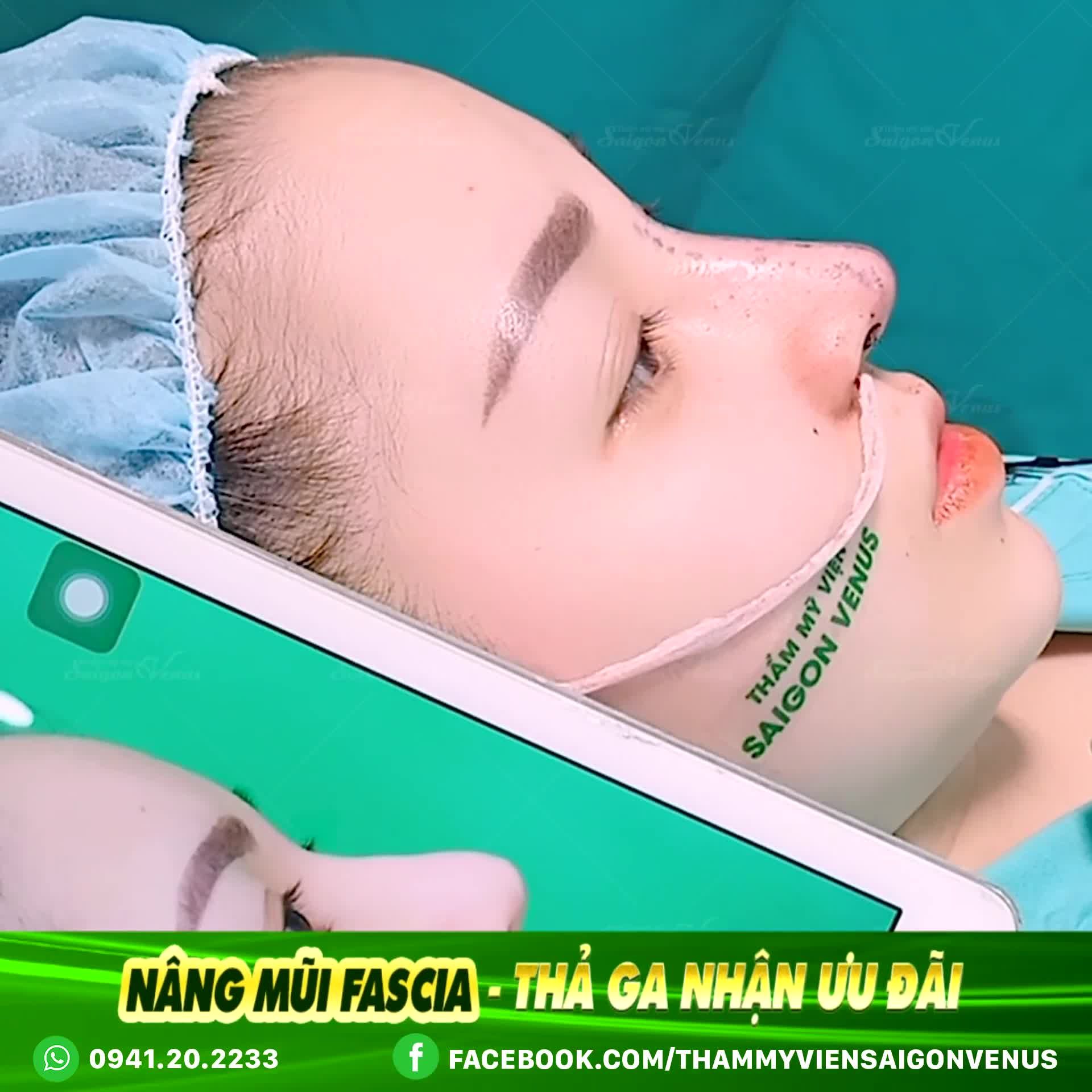 KẾT QUẢ TẠI PHÒNG MỔ THAY ĐỔI DÁNG MŨI - LỘT XÁC DIỆN MẠO