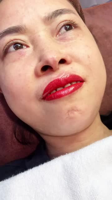 Môi thâm , sắc tố môi không đều, thiếu sắc nét, Xử lí thế nàoooo?