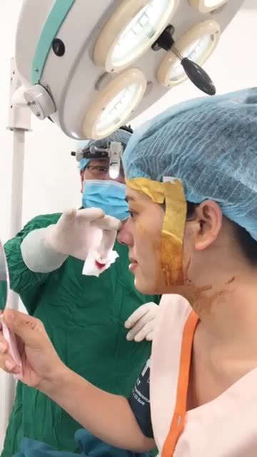 Mũi cấu trúc SLine - Khách ưng ngay từ lần đầu tiên ngồi dậy xem