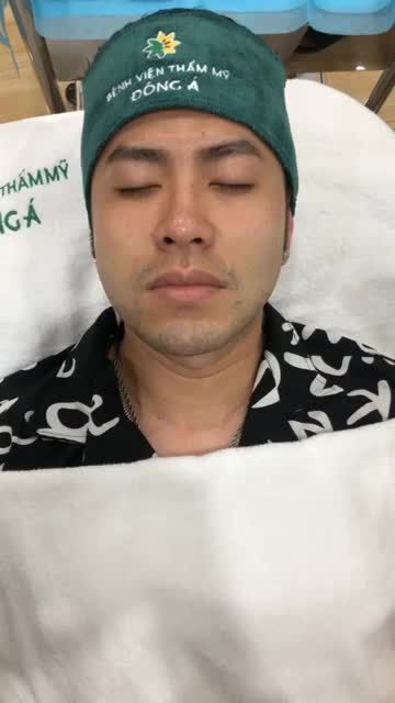 Cận cảnh quá trình tiêm Filler rãnh mũi má cho ca sĩ Akita Phan Tại bệnh viện thẩm Mỹ Đông Á