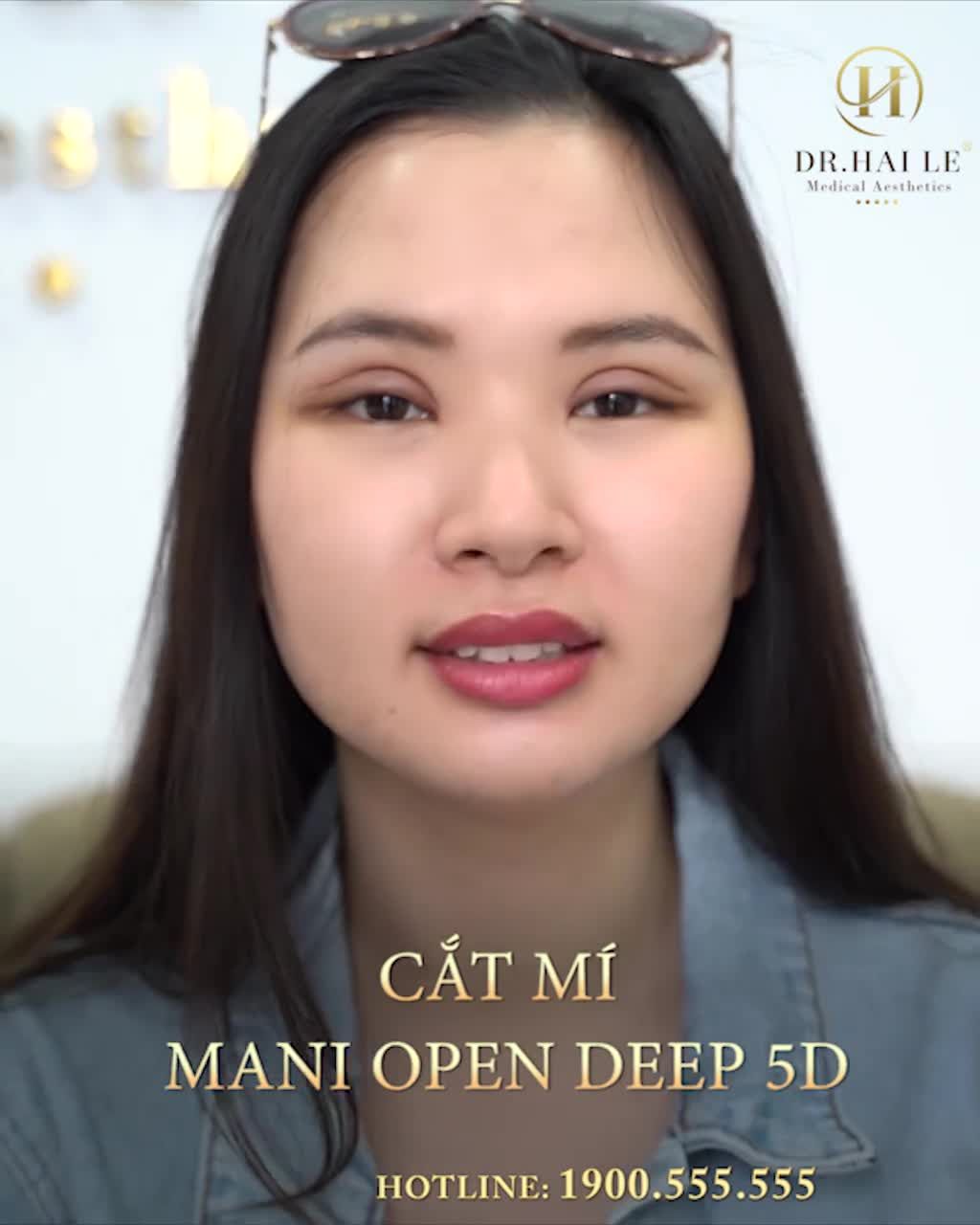 CẮT MÍ THAY ĐỔI DIỆN MẠO GƯƠNG MẶT CỦA BẠN NHƯ THẾ NÀO???