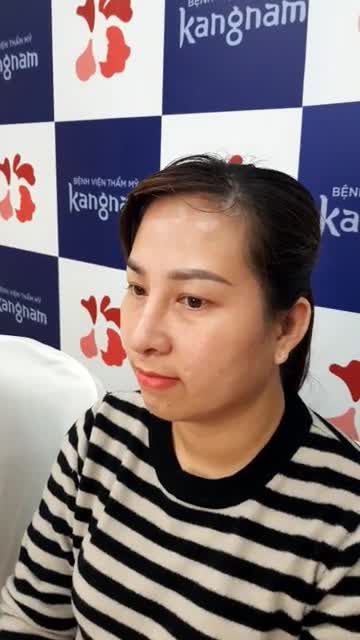 Chọn nâng mũi - Thăng hạng nhan sắc