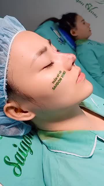 MŨI ĐẸP TRỰC TIẾP TẠI PHÒNG MỔ