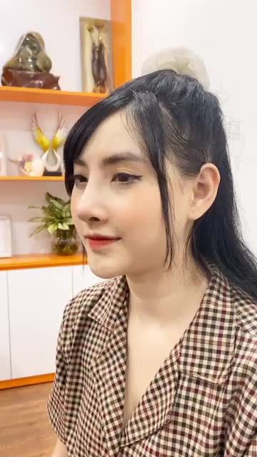 Mũi Surgiform vào form như thế nào sau 10 ngày?