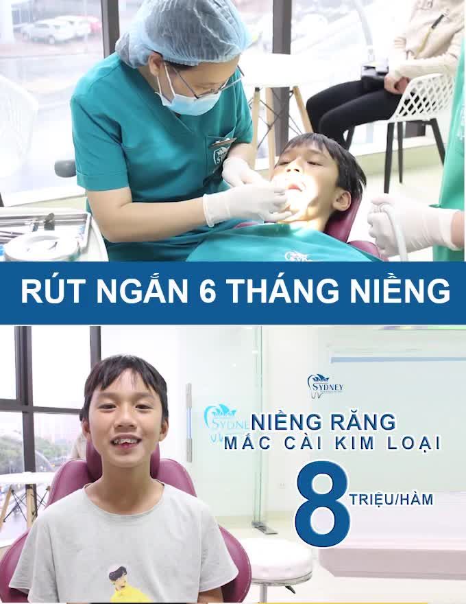 NIỀNG RĂNG KHẤP KHỂNH NHƯ THẾ NÀO