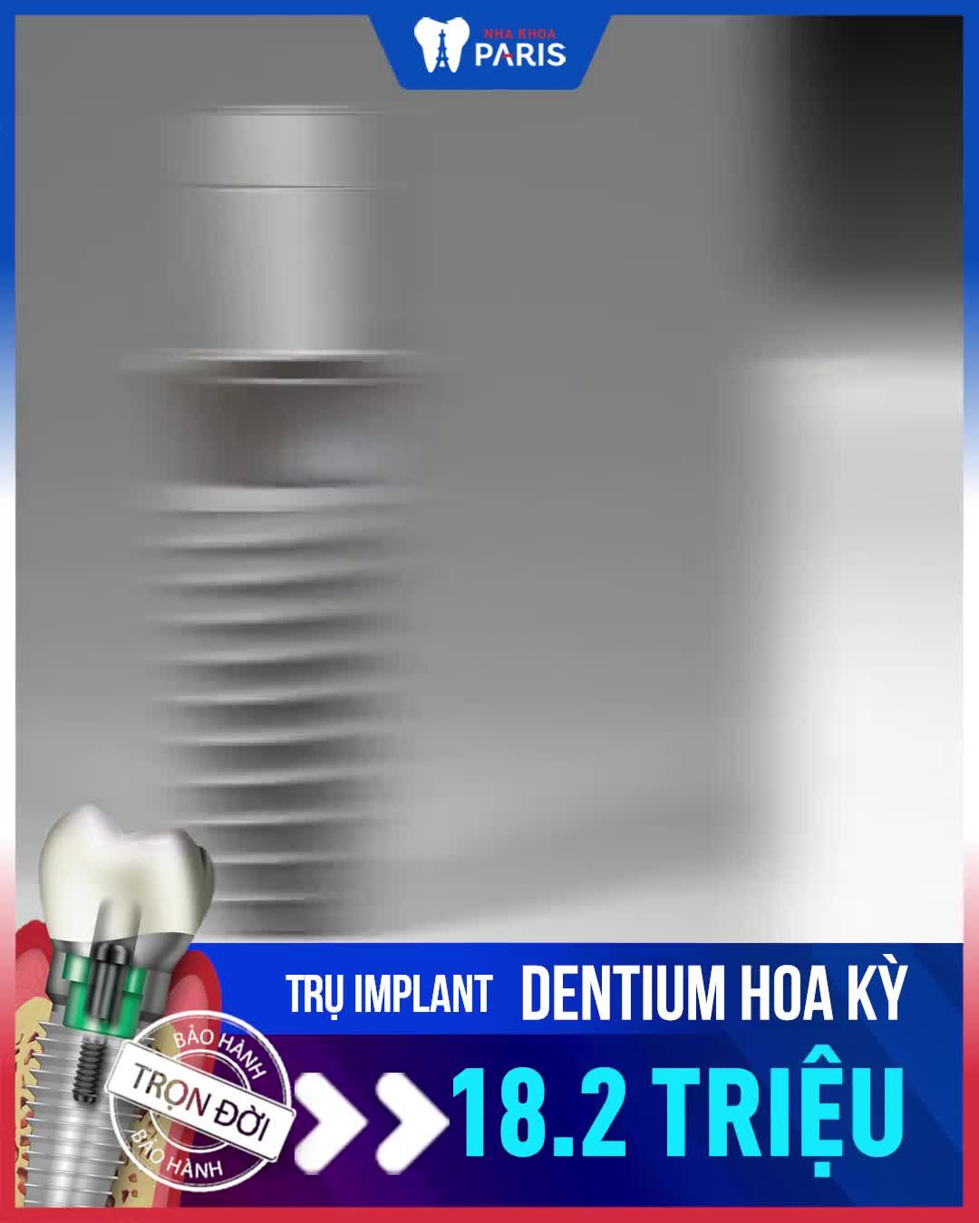 Trồng răng Implant -20%  -  Giảm thêm 1 triệu