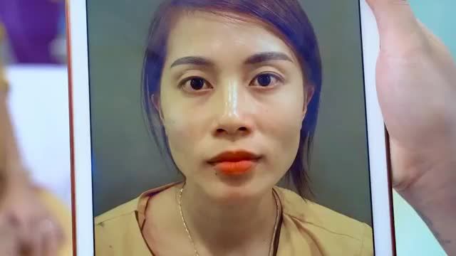 Mắt khó, nhiều khuyết điểm ở mức độ nào đội ngũ Bác sĩ tại Dr.Hải Lê đều có thể khắc phục và mang đến cho khách hàng khuôn mí đẹp tự nhiên nhẹ nhàng, ít sưng, đau nhất
