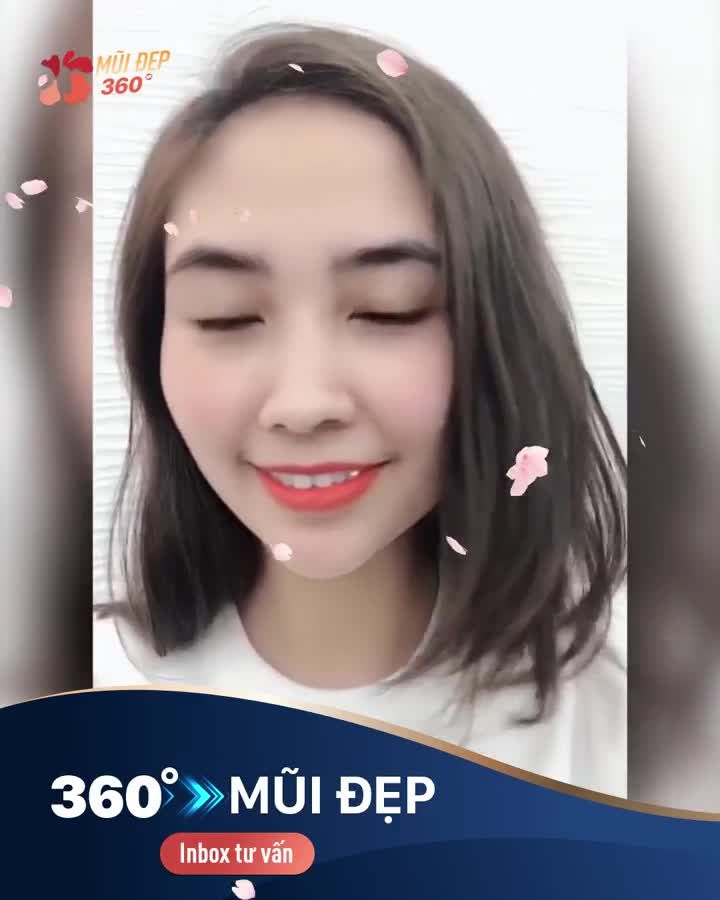 Mũi đẹp mọi góc độ Xấu kiểu nào sửa kiểu đó Inbox để tư vấn chuyên gia