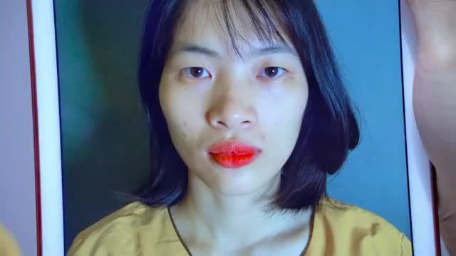Bị chê khuôn mắt dữ dằn già nua cô gái quyết tâm thay đổi để trở nên trẻ trung rạng rỡ hơn nhờ tiểu phẫu Cắt mí tại Dr.Hải Lê