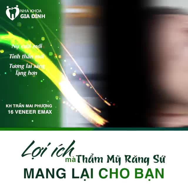 NHỮNG LỢI ÍCH TUYỆT VỜI GIÚP BẠN QUYẾT ĐỊNH CÓ NÊN THẨM MỸ RĂNG