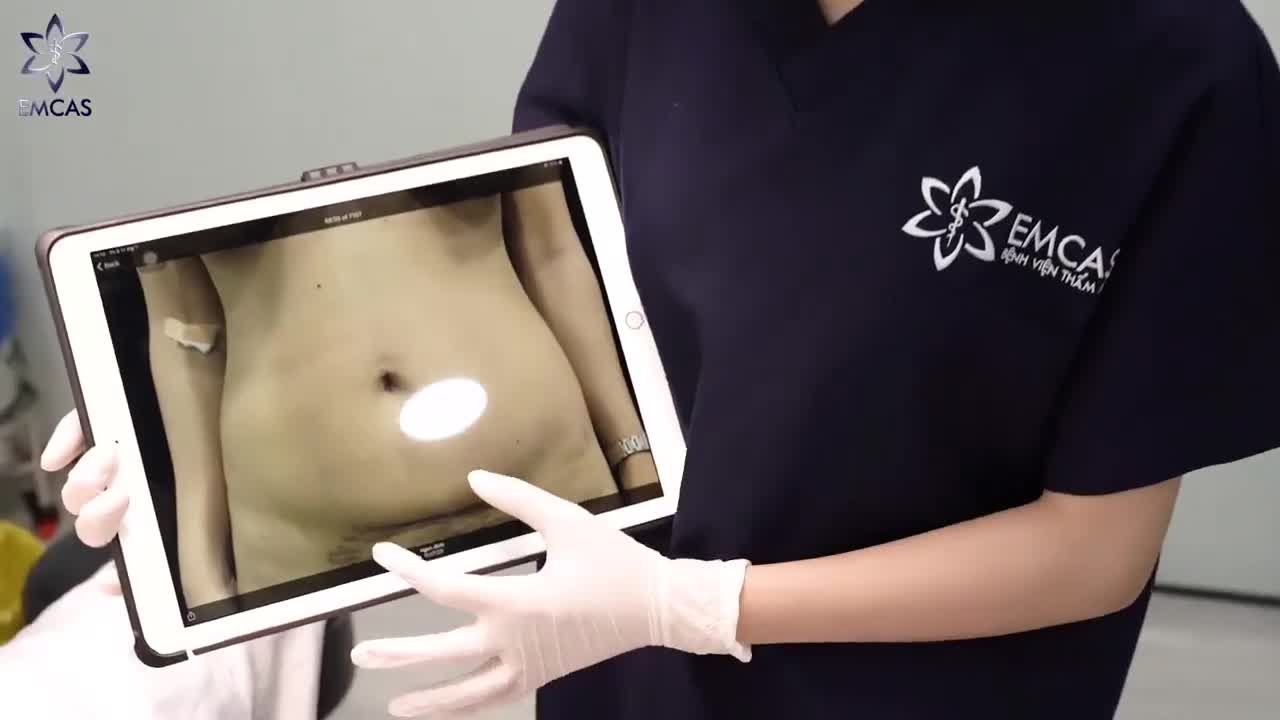 TẠO HÌNH EO THON LÝ TƯỞNG LỘT XÁC CHỈ SAU 90 PHÚT