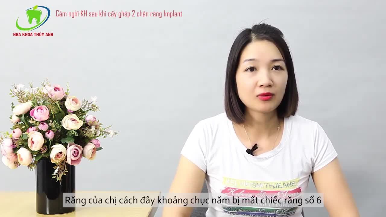 TRỒNG IMPLANT HAY CẦU RĂNG SỨ ???