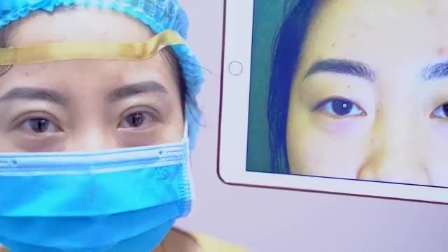 Mời quý khách hàng cùng chiêm ngưỡng kết quả Cắt mí vừa thực hiện xong để có thêm động lực